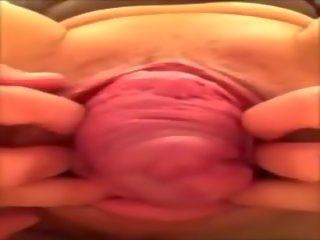 Super cervix prolaps: free pornhub super porno video 1e